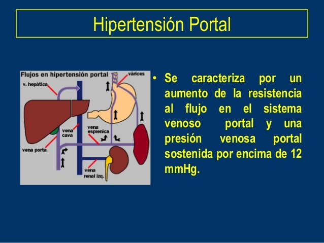 Prueba que es la hipertensión intracraneal