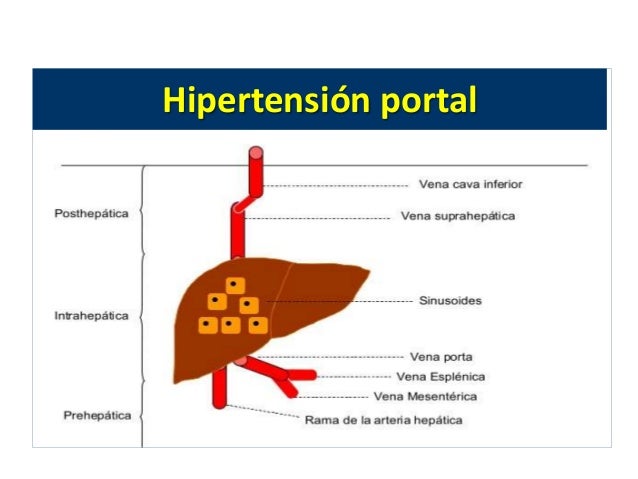remedios hipertensión suplements