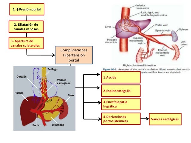 Sirosis hepatic adalah pdf creator