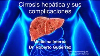 Cirrosis hepática y sus
complicaciones
Medicina Interna
Dr. Roberto Gutiérrez
Itzel Roacho Rodríguez
Claudia Janeth Ramírez
 