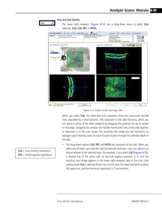 Ilm Rpe Thinkness Numbers Example Cirrus 6.0.2 user manual english dr.boonsong | PDF