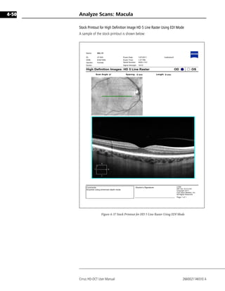 Hd 5 Line Raster Cirrus 6.0.2 user manual english dr.boonsong | PDF
