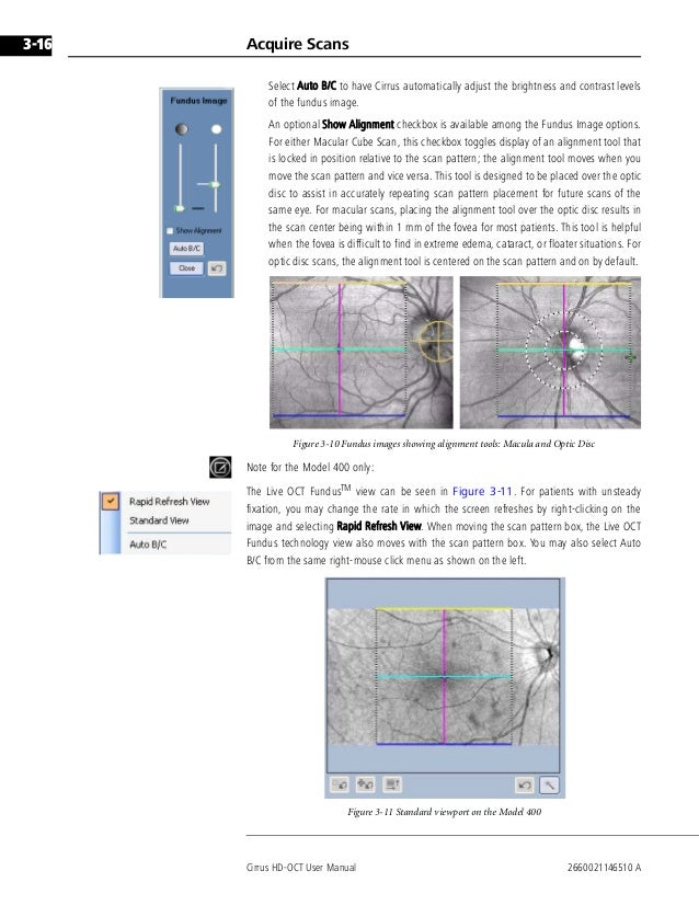 Cirrus Hd Oct 500 User Manual Cirrus Hd Oct 500 User Manual