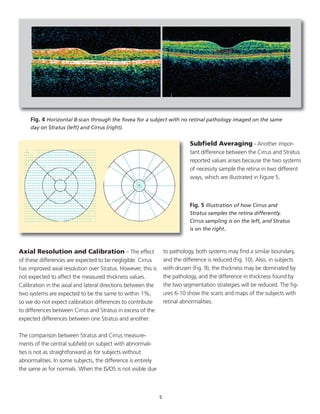 Axial Resolution and Calibration – The effect
of these differences are expected to be negligible. Cirrus
has improved axial resolution over Stratus. However, this is
not expected to affect the measured thickness values.
Calibration in the axial and lateral directions between the
two systems are expected to be the same to within 1%,
so we do not expect calibration differences to contribute
to differences between Cirrus and Stratus in excess of the
expected differences between one Stratus and another.
The comparison between Stratus and Cirrus measure-
ments of the central subfield on subject with abnormali-
ties is not as straightforward as for subjects without
abnormalities. In some subjects, the difference is entirely
the same as for normals. When the IS/OS is not visible due
to pathology, both systems may find a similar boundary,
and the difference is reduced (Fig. 10). Also, in subjects
with drusen (Fig. 9), the thickness may be dominated by
the pathology, and the difference in thickness found by
the two segmentation strategies will be reduced. The fig-
ures 6-10 show the scans and maps of the subjects with
retinal abnormalities.
5
Fig. 4 Horizontal B-scan through the fovea for a subject with no retinal pathology imaged on the same
day on Stratus (left) and Cirrus (right).
Subfield Averaging - Another impor-
tant difference between the Cirrus and Stratus
reported values arises because the two systems
of necessity sample the retina in two different
ways, which are illustrated in Figure 5.
Fig. 5 Illustration of how Cirrus and
Stratus samples the retina differently.
Cirrus sampling is on the left, and Stratus
is on the right.
 