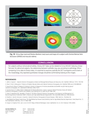 REFERENCES
1. Jaffe G, Caprioli C. Optical Coherence Tomography to Detect and Manage Retinal Disease and Glaucoma. Am J Ophthal. 2004 Jan; 137(1): 156-169.
2. Otani T, Kishi S, Maruyama Y. Patterns of Diabetic Macular Edema with Optical Coherence Tomography. Am J Ophthal 1999 June;127(6):688-693.
3. Haouchine B, Massin P, Tadayoni R, Erginay A, Gaudric A. Diagnosis of macular pseudoholes and lamellar macular holes by optical
coherence tomography. Am J Ophthalmol 2004 Nov;138(5):732-9.
4. Sanchez-Tocino H, Valdez-Vidal A, Maldonado M, Moreno-Montanes J, Garcia –Layana A. Retinal Thickness Study with Optical
Coherence Tomography in Patients with Diabetes. Inves Ophthal Visc Sci 2002 Oct;43:1588-1594.
5. Polito A, Napolitano MC, Bandello F, Chiodini R. The Role of Optical Coherence Tomography in the Diagnosis and Management of
Retinal Angiomatous Proliferation (RAP) in Patients with Age-related Macular Degeneration. Ann Acad Med 2006 June; 35(6):420-424.
6. Puliafito C, Hee M, Schuman J, Fujimoto J. Optical Coherence Tomography of Ocular Diseases. 1996, Slack Inc., Thorofare, NJ.
7. Age-Related Eye Disease Study Group. The Age-Related Eye Disease Study Sevberity Scale for Age Related Macular Degenration: Areds Report No. 17.
Arch Ophthalmol. 2005 Nov; 123 (11) 1484-1498.
8. Gregori G, Knighton R.W., Jiao S, et al. 3-D OCT Maps of Retinal Pathologies. Invest. Ophthalmol. Vis. Sci. 46: E-Abstract 1055 (2005).
CONCLUSION
For subjects without retinal abnormalities, Stratus OCT data can be related to Cirrus HD-OCT data by a linear
formula. For abnormal subjects, the relationship between subfields may vary according to pathology. When
comparing Cirrus data to Stratus data, it is essential to examine carefully the OCT tomograms and to look at
the morphology. Any reported quantitative changes should be confirmed by looking at the images.
Fig. 10 Cirrus (top row) and Stratus (bottom row) scans and maps of a subject with Central Retinal Vein
Occlusion (CRVO) and macular edema.
Carl Zeiss Meditec Inc.
5160 Hacienda Drive
Dublin, CA 94568
USA
Phone: 1-800-342-9821
Fax: 1-925-557-4101
info@meditec.zeiss.com
www.meditec.zeiss.com
RET.1672
©2007,CarlZeissMeditec,Inc.Allrightsreserved.Specificationssubjecttochange.PrintedinUSA.11071M
ILM-RPE Thickness (µm)
 