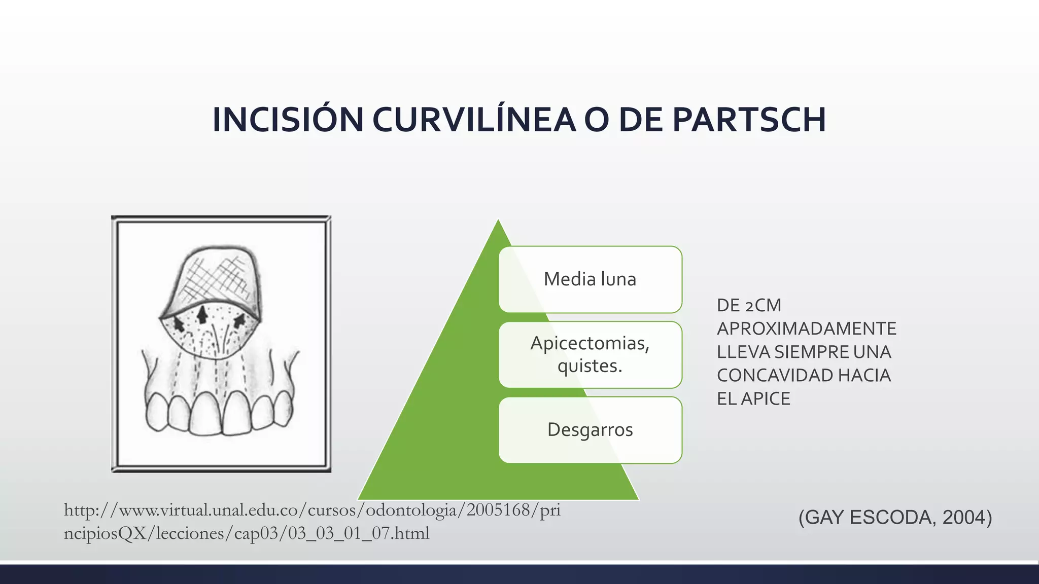 Cirugía oral - INCISION Y COLGAJO | PPTX