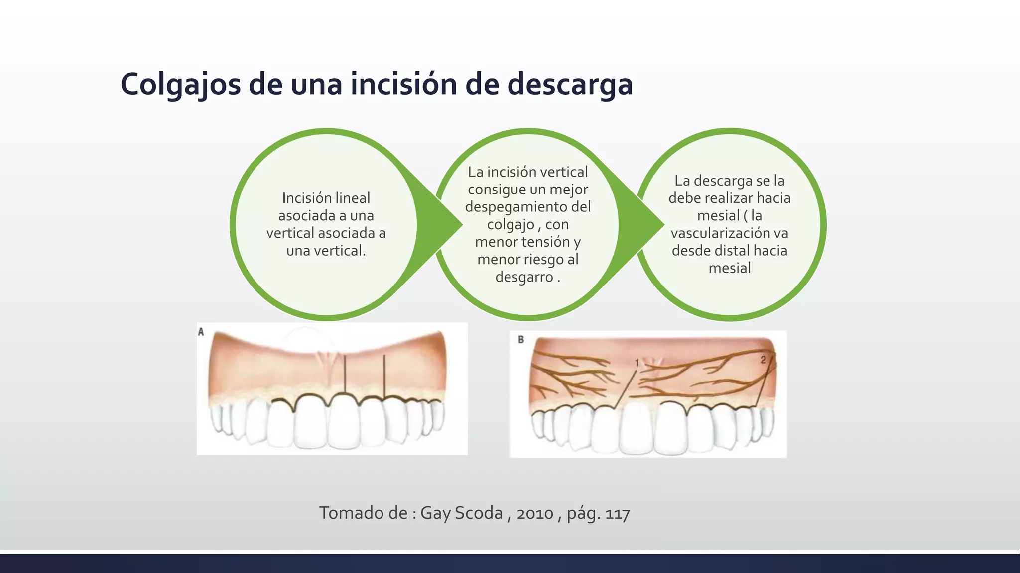 Cirugía oral - INCISION Y COLGAJO | PPTX