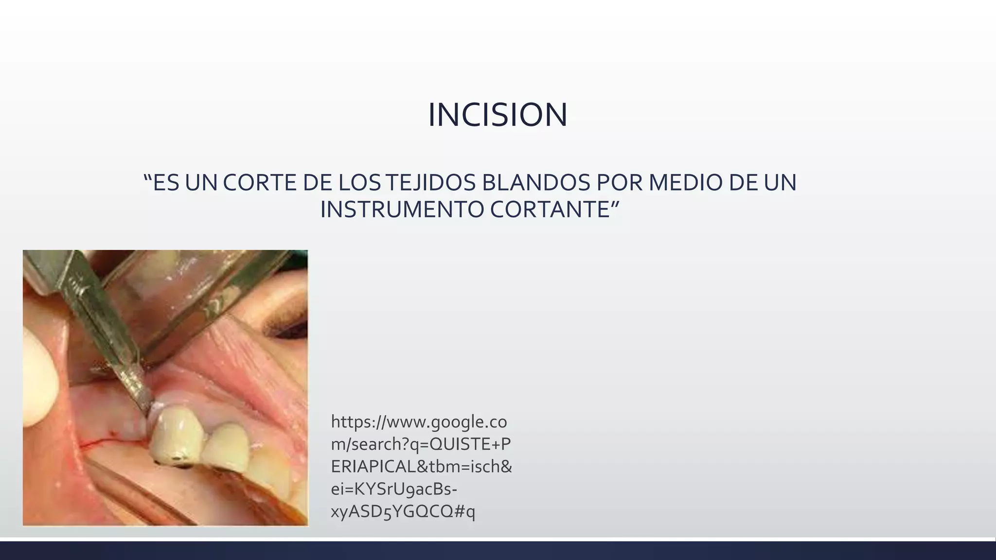 Cirugía oral - INCISION Y COLGAJO | PPTX