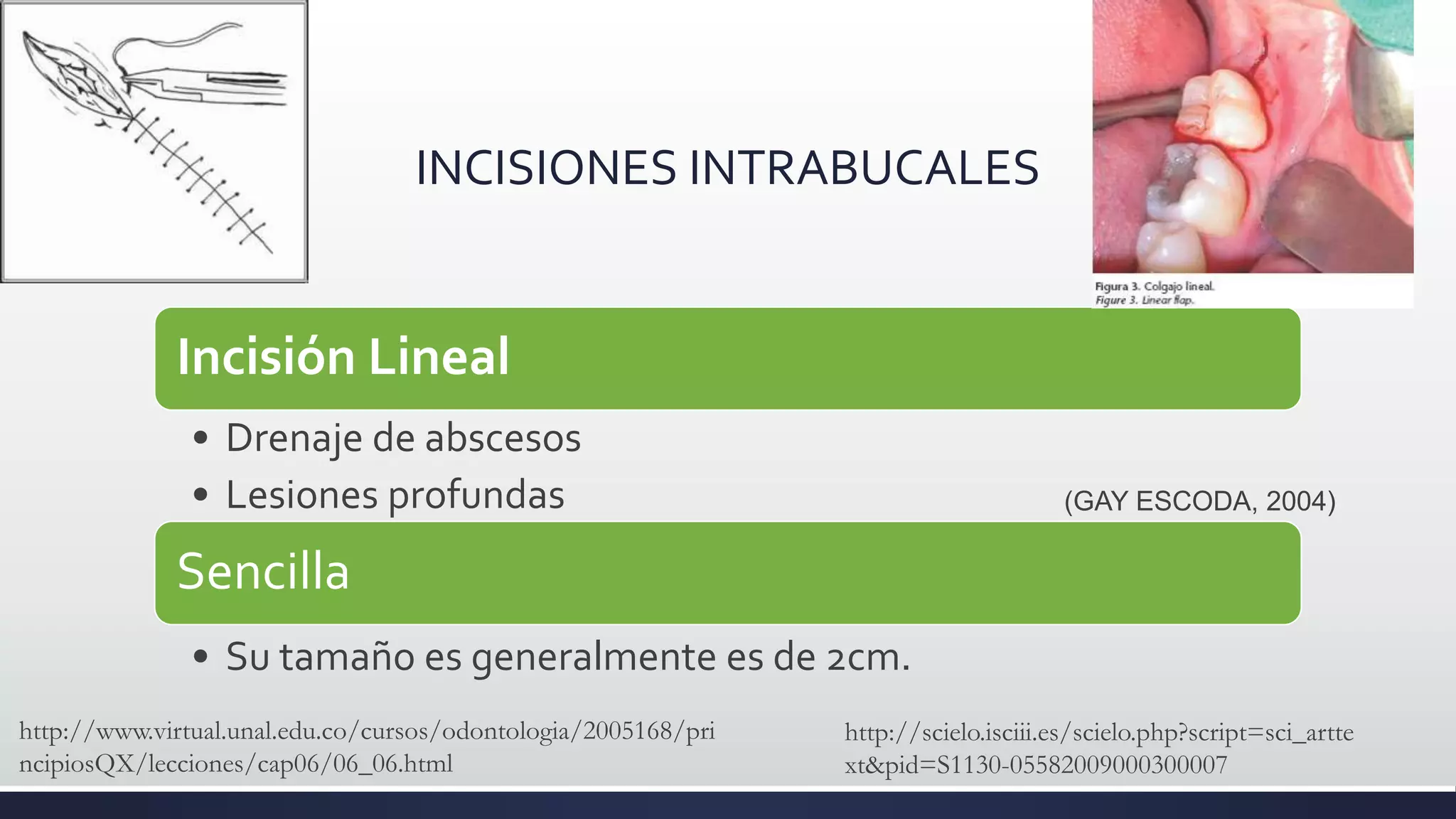 Y Incision Vst Cirugía oral - INCISION Y COLGAJO | PPTX