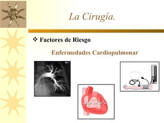 La Cirugía.  Factores de Riesgo  Enfermedades Cardiopulmonar 