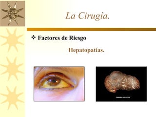 La Cirugía.  Factores de Riesgo  Hepatopatías.  