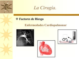 La Cirugía.
 Factores de Riesgo
Enfermedades Cardiopulmonar
 