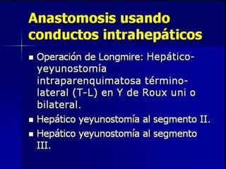 Cirugía   coledocolitiasis y estenosis del esfinter de oddi. derivación biliodigestiva y esfinteroplastía