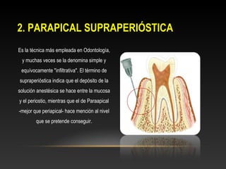 2. PARAPICAL SUPRAPERIÓSTICA2. PARAPICAL SUPRAPERIÓSTICA
Es la técnica más empleada en Odontología,
y muchas veces se la denomina simple y
equívocamente "infiltrativa". El término de
supraperióstica indica que el depósito de la
solución anestésica se hace entre la mucosa
y el periostio, mientras que el de Paraapical
-mejor que periapical- hace mención al nivel
que se pretende conseguir.
 