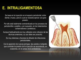 E. INTRALIGAMENTOSAE. INTRALIGAMENTOSA
Se basa en la inyección en el espacio periodontal, entre
diente y hueso, para lo cual se necesita ejercer una gran
presión.
Por ello está totalmente contraindicada en los procesos de
periodontitis o pulpitis y, por supuesto, en los tratamientos
conservadores o protésicos.
Aunque habitualmente es muy utilizada como refuerzo de las
técnicas anteriores, su uso debe ser proscrito.
Es muy dolorosa y favorece la difusión de infecciones
periodontales.
Con la aparición de nuevas jeringas, tipo pistola o bolígrafo,
que controlan la presión de la inyección se recomienda, en
ocasiones, en el campo de la endodoncia.
 