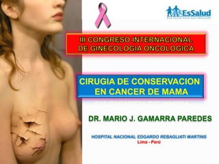 CIRUGIA DE CONSERVACION
EN CANCER DE MAMA
DR. MARIO J. GAMARRA PAREDES
HOSPITAL NACIONAL EDGARDO REBAGLIATI MARTINS
Lima - Perú
 