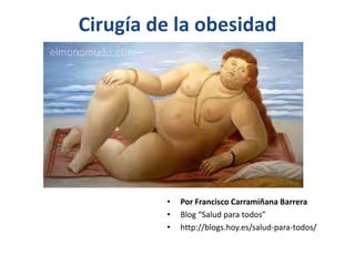 Cirugía de la obesidad
• Por Francisco Carramiñana Barrera
• Blog “Salud para todos”
• http://blogs.hoy.es/salud-para-todos/
 