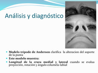 Análisis y diagnóstico
 Modelo trípode de Anderson clarifica la alteracion del soporte
de la punta
 Este modelo muestra:
 Longitud de la crura medial y lateral cuando se evalua
proyección, rotación y ángulo columela-labial
 