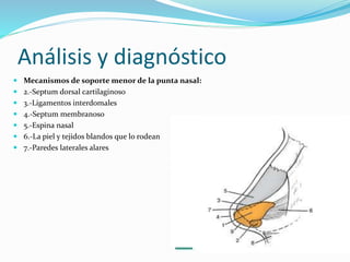 Análisis y diagnóstico
 Mecanismos de soporte menor de la punta nasal:
 2.-Septum dorsal cartilaginoso
 3.-Ligamentos interdomales
 4.-Septum membranoso
 5.-Espina nasal
 6.-La piel y tejidos blandos que lo rodean
 7.-Paredes laterales alares
 