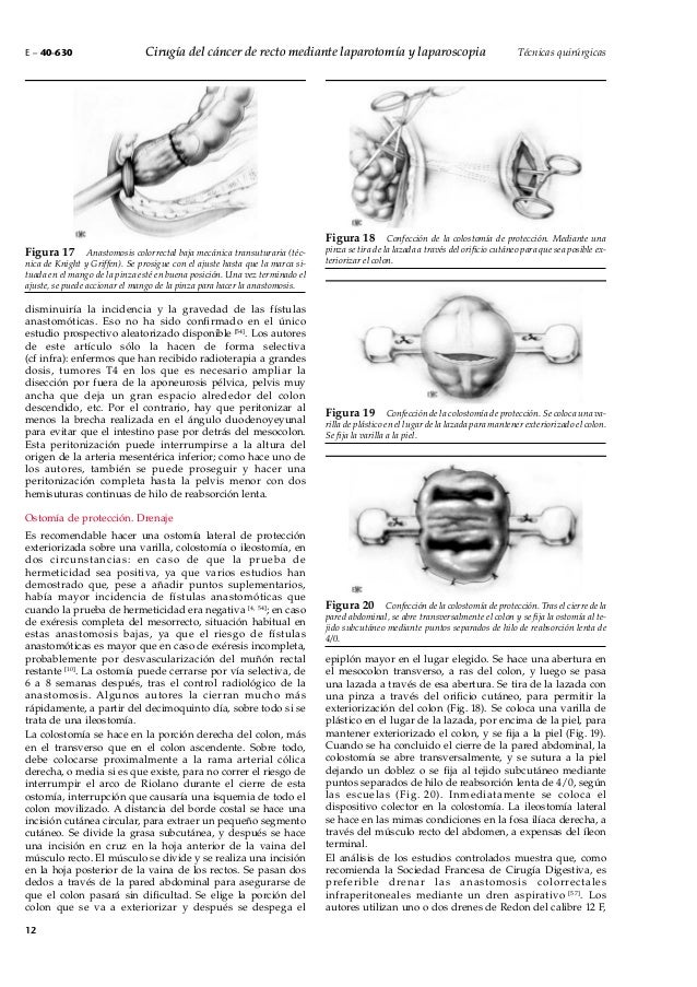 Proctotomy Rectotomia Posterior , Posterior rectotomy Übersetzung in Deutsch ...