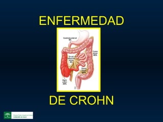 ENFERMEDAD DE CROHN 