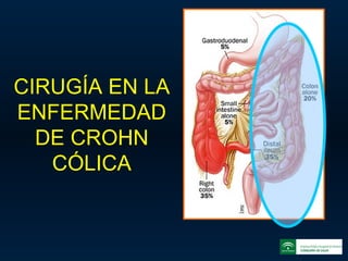 CIRUGÍA EN LA ENFERMEDAD DE CROHN CÓLICA 