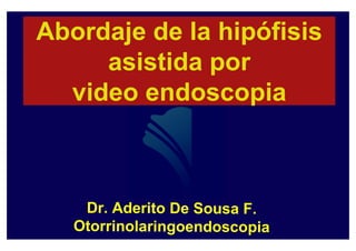 Abordaje de la hipófisis
 bo daje     a pó s s
     asistida por
  video endoscopia
 
