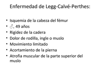 Enfermedad de Legg-Calvé-Perthes: Isquemia de la cabeza del fémur ♂ ,  49 años Rigidez de la cadera Dolor de rodilla, ingle o muslo Movimiento limitado Acortamiento de la pierna Atrofia muscular de la parte superior del muslo 