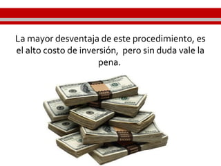 La mayor desventaja de este procedimiento, es
el alto costo de inversión, pero sin duda vale la
pena.
 