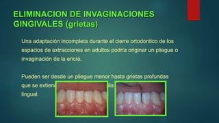 Cirugías Periodontales en Ortodoncia 2017.pptx