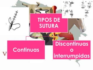 TIPOS DE
SUTURA

Continuas

Discontinuas
o
interrumpidas

 