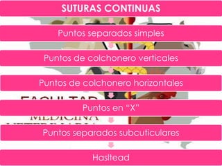 SUTURAS CONTINUAS
Puntos separados simples
Puntos de colchonero verticales

Puntos de colchonero horizontales
Puntos en “X”
Puntos separados subcuticulares
Hasltead

 