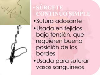 • SÚRGETE
CONTINUO SIMPLE
•Sutura adosante
•Usada en tejidos
bajo tensión, que
requieren buena
posición de los
bordes
•Usada para suturar
vasos sanguíneos

 