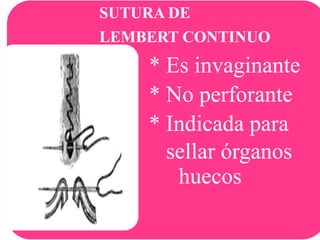 SUTURA DE
LEMBERT CONTINUO

•
•
•
•

* Es invaginante
* No perforante
* Indicada para
sellar órganos
huecos

 