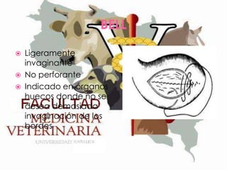 BELL




Ligeramente
invaginante
No perforante
Indicado en órganos
huecos donde no se
desea demasiada
invaginación de los
bordes

 