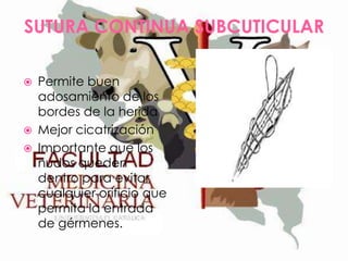 SUTURA CONTINUA SUBCUTICULAR






Permite buen
adosamiento de los
bordes de la herida
Mejor cicatrización
Importante que los
nudos queden
dentro para evitar
cualquier orificio que
permita la entrada
de gérmenes.

 