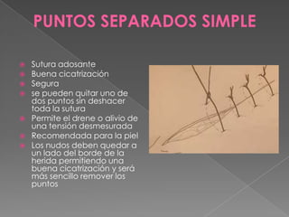PUNTOS SEPARADOS SIMPLE









Sutura adosante
Buena cicatrización
Segura
se pueden quitar uno de
dos puntos sin deshacer
toda la sutura
Permite el drene o alivio de
una tensión desmesurada
Recomendada para la piel
Los nudos deben quedar a
un lado del borde de la
herida permitiendo una
buena cicatrización y será
más sencillo remover los
puntos

 