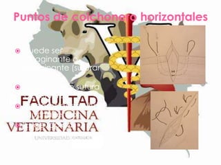 Puntos de colchonero horizontales






Puede ser
invaginante o
evaginante (suturar
piel)
Usada como sutura
de refuerzo
En casos donde hay
mucha tensión
Es de rápida
aplicación y es
bastante resistente

 