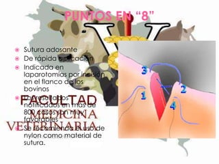 PUNTOS EN “8”








Sutura adosante
De rápida aplicación
Indicada en
laparotomías por incisión
en el flanco de los
bovinos
Los resultados
notificados en más de
800 casos son muy
favorables
Se recomienda el uso de
nylon como material de
sutura.

 
