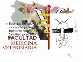 CERCA Y LEJOS


Este tipo de sutura es
adosante y ofrece
bastante resistencia.
Se utiliza para suturar
piel.

 