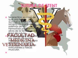 SUTURA DE STENT
Se practica en caso de
que una herida
quirúrgica suturada siga
sangrando logrando,
además de la
hemostasis por presión,
alivio de la tensión en la
línea de sutura.
 Consiste en fijar la herida
por medio de puntos
separados con una gasa
enrollada. Los puntos
atraviesan la piel, tejido
subcutáneo y fascia
muscular.




 