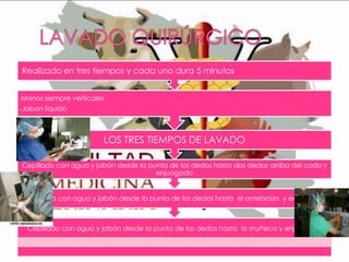 Realizado en tres tiempos y cada uno dura 5 minutos
Manos siempre verticales

-

-Jabon liquido

LOS TRES TIEMPOS DE LAVADO
Cepillado con agua y jabón desde la punta de los dedos hasta dos dedos arriba del codo y
enjuagado

Cepillado con agua y jabón desde la punta de los dedos hasta el antebrazo y enjuagado

Cepillado con agua y jabón desde la punta de los dedos hasta la muñeca y enjuagado

 