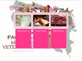 PREVENTIVA

TEMPORAL

DEFINITIVA

 