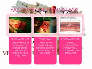 EXTRAVASCULAR

VASCULAR

INTRAVASCULAR

Depende de la
naturaleza y
cantidad de
tejido que
rodea al vaso
sangrante

Dado por el
enrollamiento
hacia el exterior
de la intima de
los vasos

Dados
coagulación
sanguinea y
cambios en las
plaquetas

 