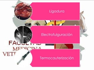 Ligadura

Electrofulguración

Termocauterización

 