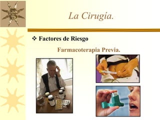 La Cirugía.
 Factores de Riesgo
Farmacoterapia Previa.
 