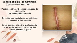 INFECCION QUIRURGICA SEPSIS YCLASIFICACION DE HERIDAS.pdf