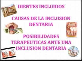 Cirugia dientes-incluidos 2 | PDF
