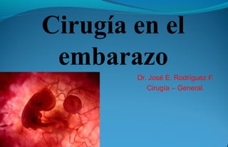Cirugía en el 
embarazo 
Dr. José E. Rodríguez F. 
Cirugía – General. 
 