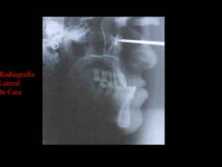 Radiografía
Lateral
De Cara
Radiografía
Lateral
De Cara
 